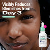 Cetaphil Purifying Blemish Serum 30mL