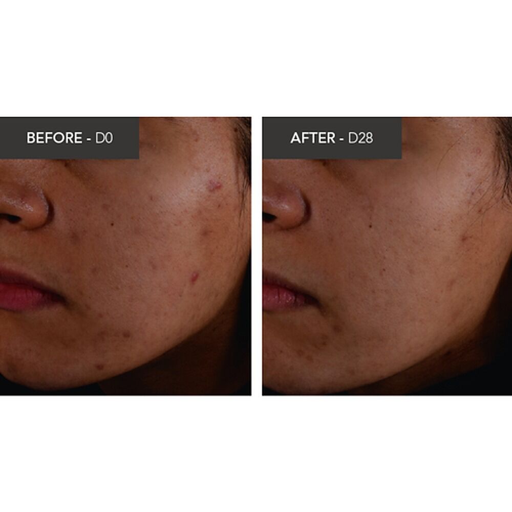 Bioderma Sebium Kerato+ Anti-Blemish Gel Cream 30mL