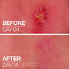 La Roche-Posay Cicaplast Baume B5+ Balm Cream 100mL