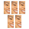 GEM Teeth Whitening Strips Crisp Mint 28 Strips Pack of 5