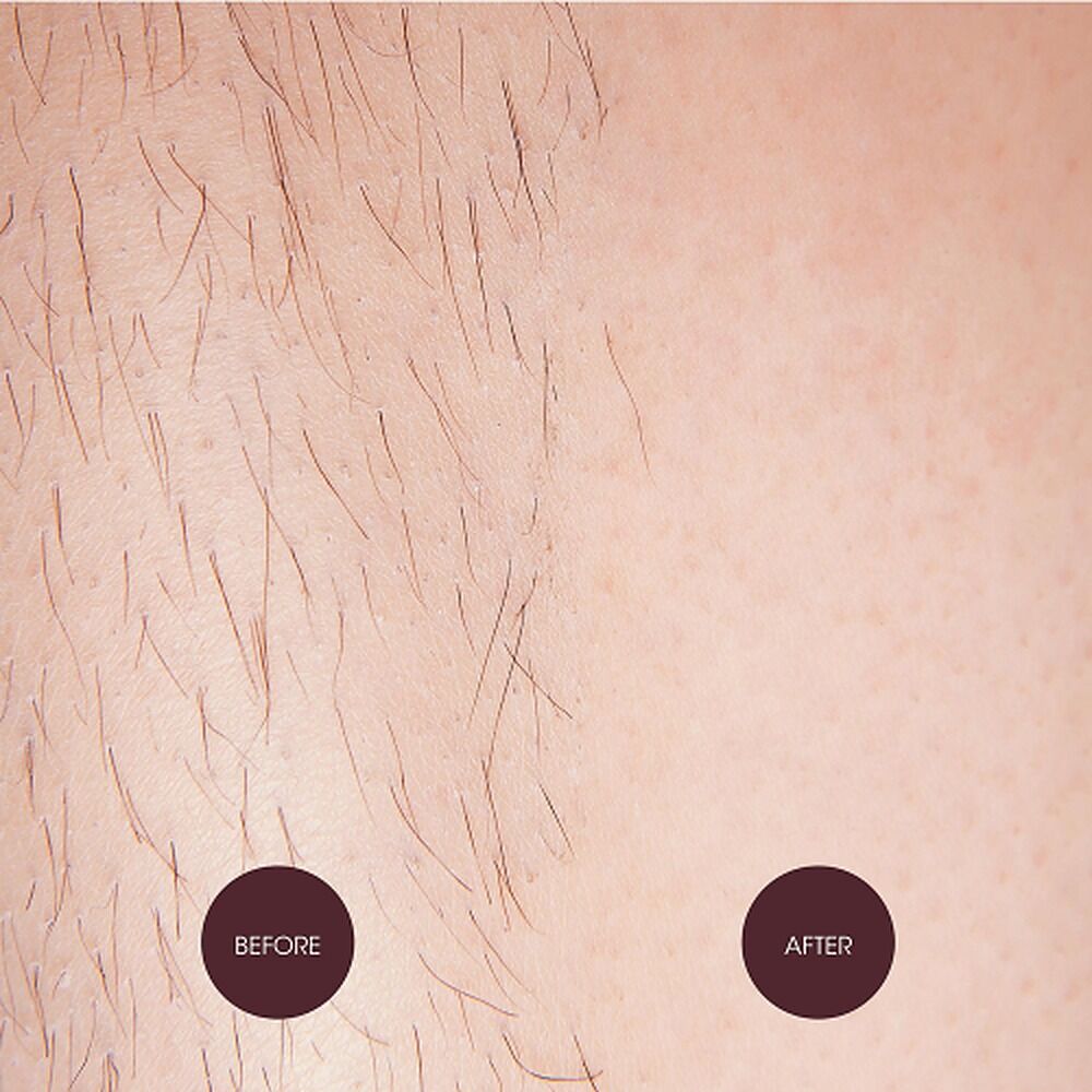 Nad's Brazilian & Bikini Wax Kit 140g