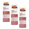 Palmer's Cocoa Butter Rosehip Skin Therapy Oil 150mL Pack of 3