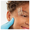 Leuko Leukosan Wound Closure Strips Assorted 9 Pack