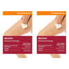 Melolin Low Adherent Wound Dressing 5cm x 5cm 5 Pack Bundle of 2