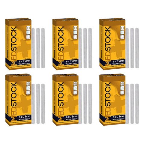 Medstock Wound Closure Strips 6mm x 75mm 50 Pack Bundle of 6