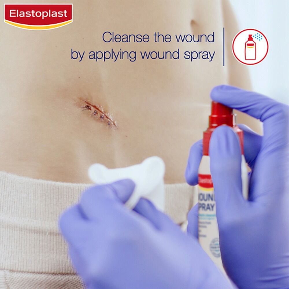 Elastoplast Wound Spray 100mL