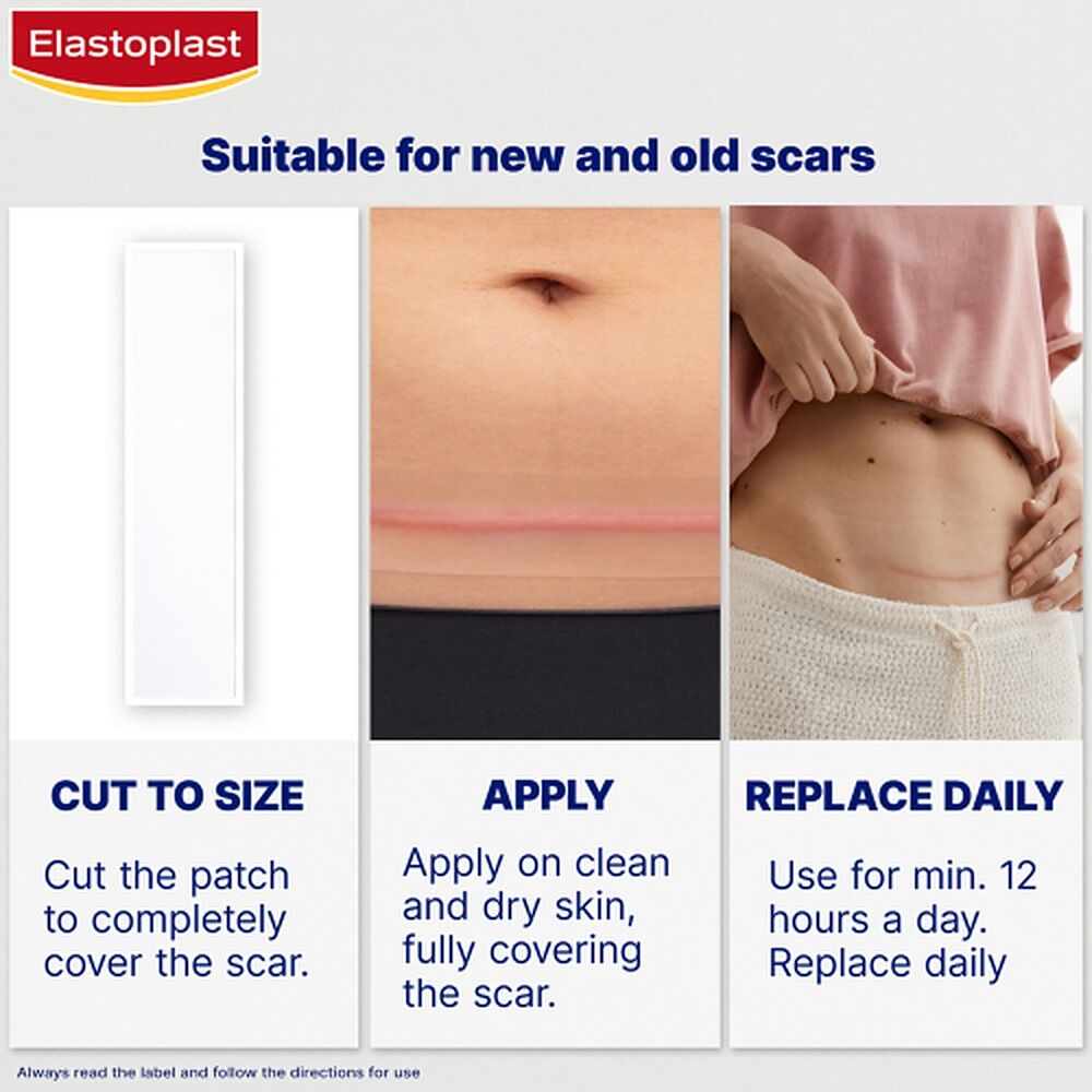 Elastoplast Scar Reducer XL 21 Pack