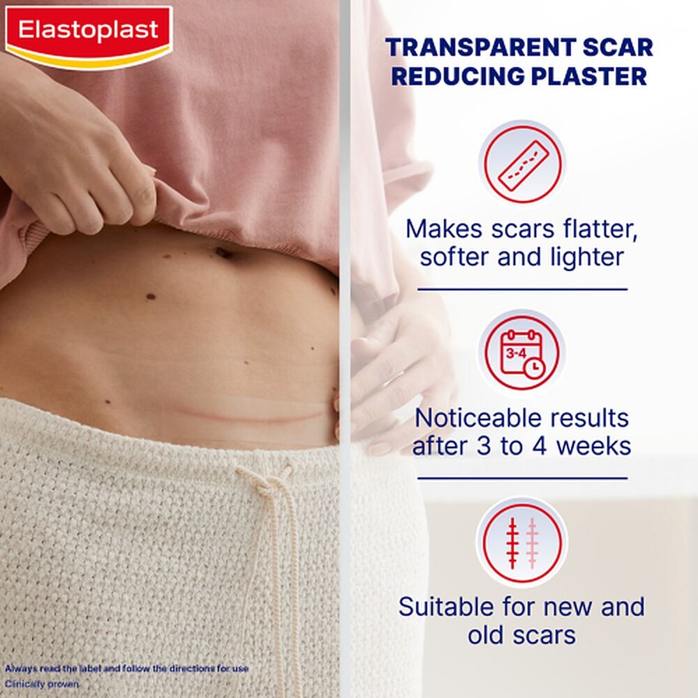 Elastoplast Scar Reducer XL 21 Pack