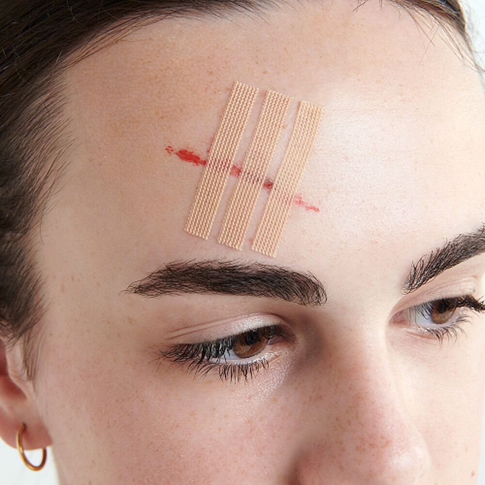 Leuko Leukostrip Wound Closure Strips 6.4mm x 76mm 3 x 3 Pack