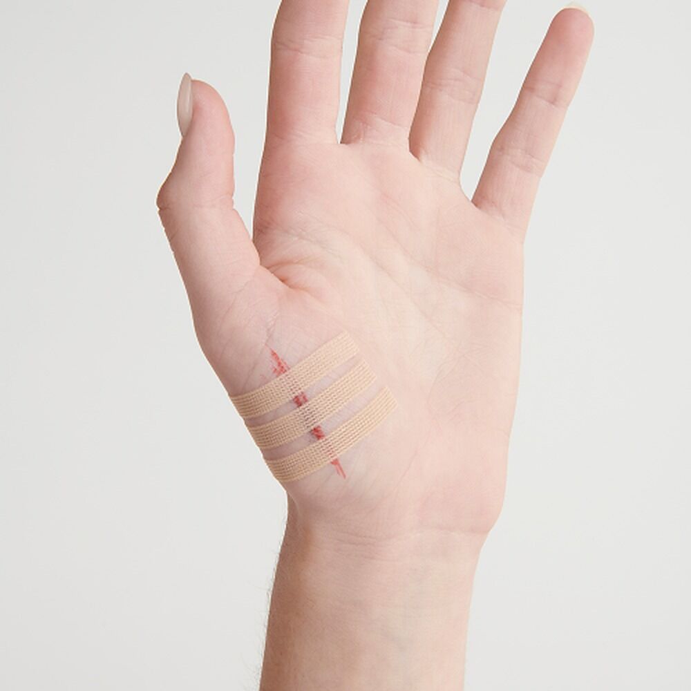 Leuko Leukostrip Wound Closure Strips 6.4mm x 76mm 3 x 3 Pack