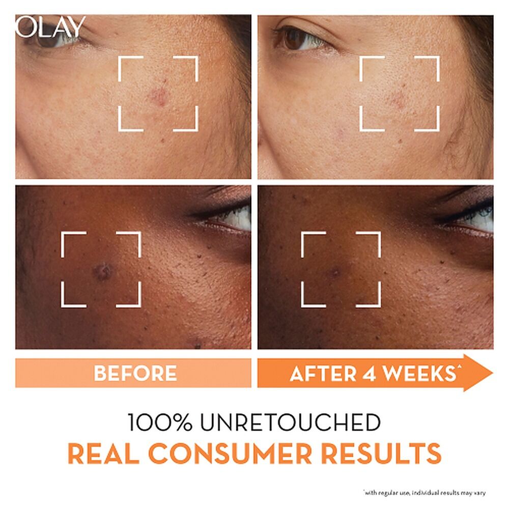 Olay Luminous Niacinamide + Vitamin C Face Moisturiser 50g