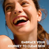 NIVEA Derma Skin Clear Wash Gel 150mL