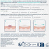 CeraVe Blemish Barrier Patches 22 Patches