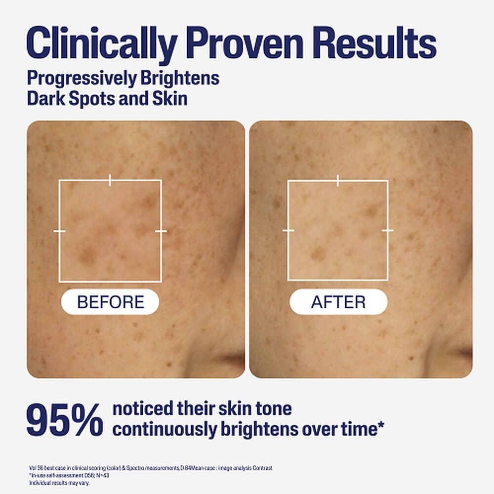 Cetaphil Bright Healthy Radiance Perfecting Serum 30mL