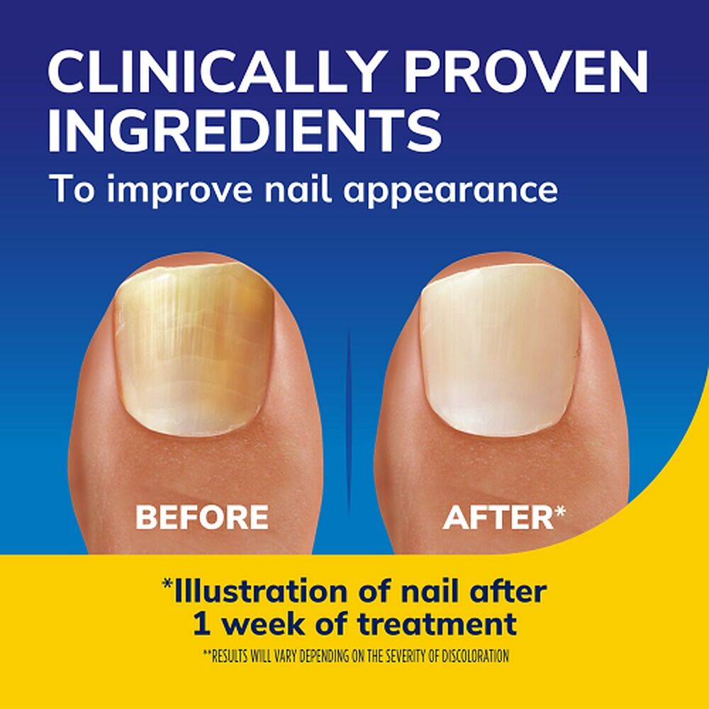 Scholl Nail Revitaliser Serum